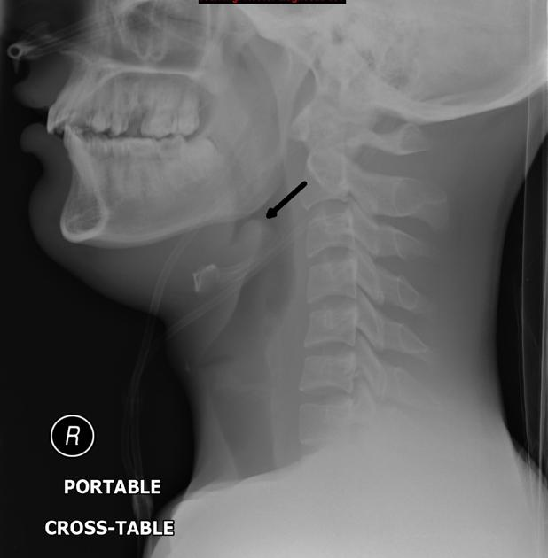 Pasted image 20260927092921.png